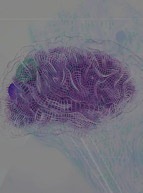 Cerebrospinal fluid (CSF)